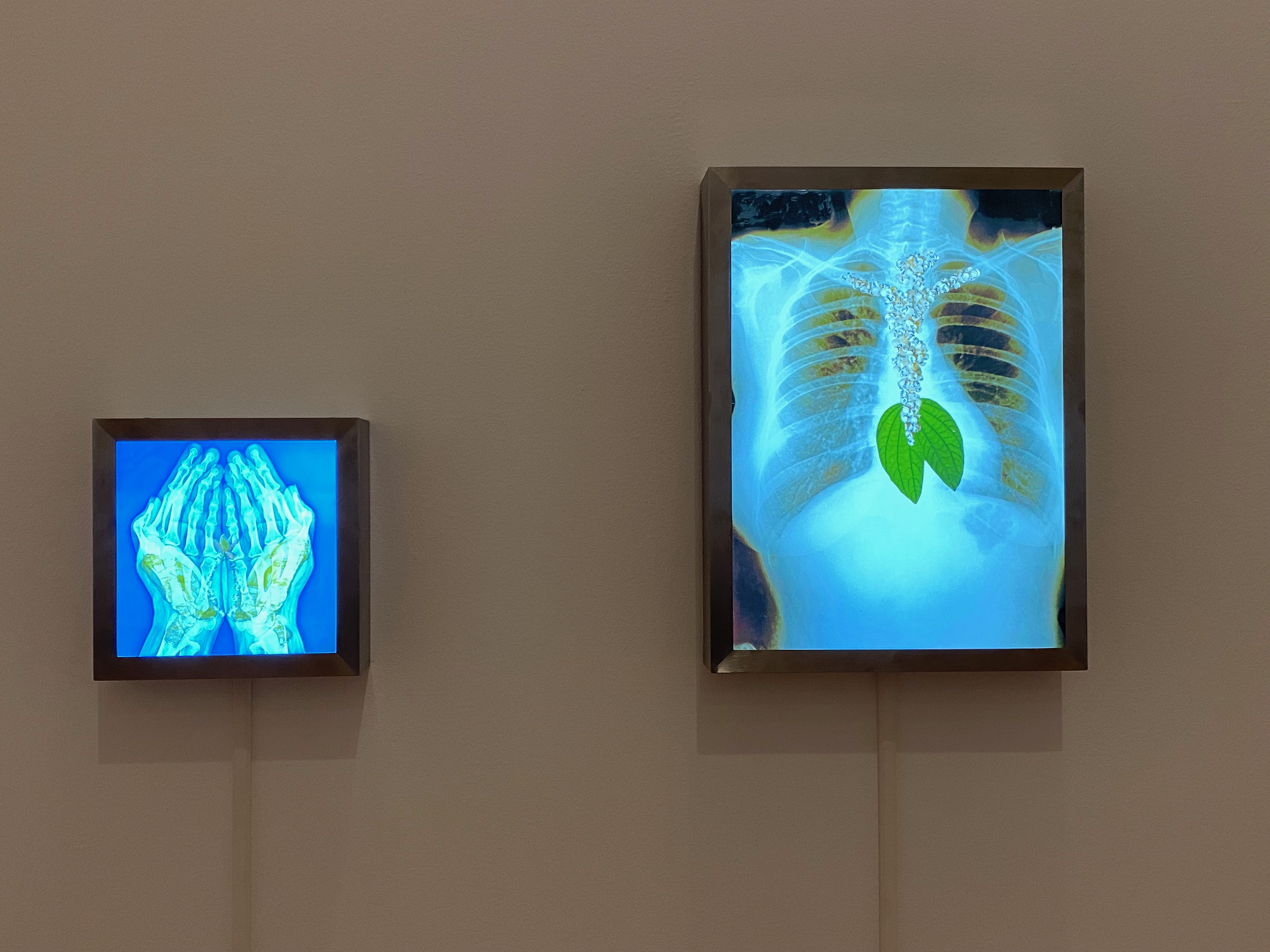 two screens side by side. One large, one small. X-rays of the body on both screens